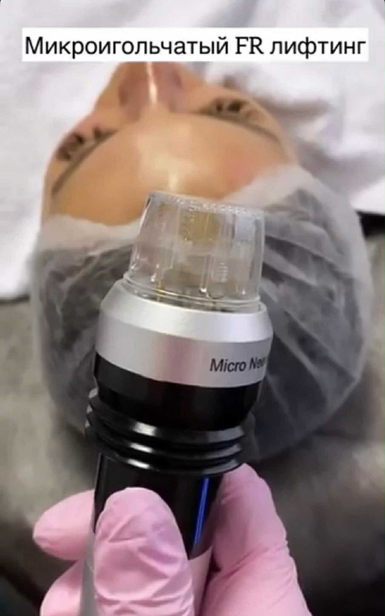 FR Microneedle device