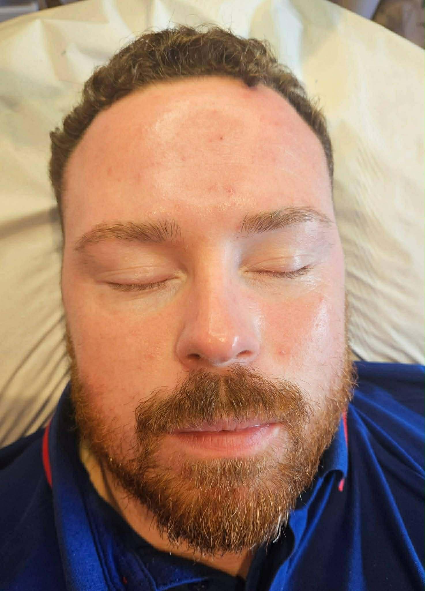Skin base treatment — before